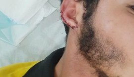 Homem que teve orelha arrancada por mordida relata que agressor circula livre pela cidade