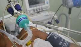Helvio Auto reduz a zero pneumonias associadas à ventilação mecânica