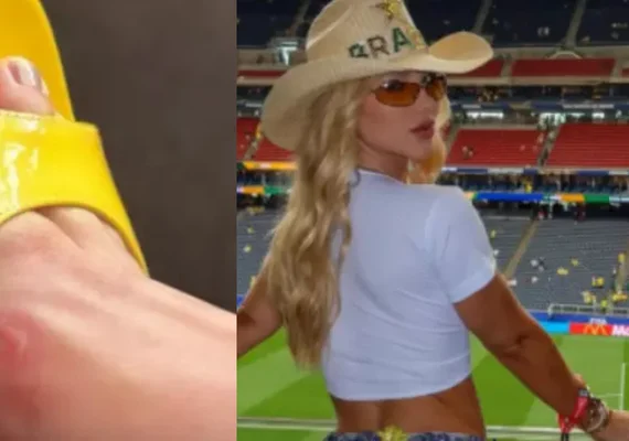 Virginia reclama que saltos fizeram calos em caminhada ao estádio da Copa