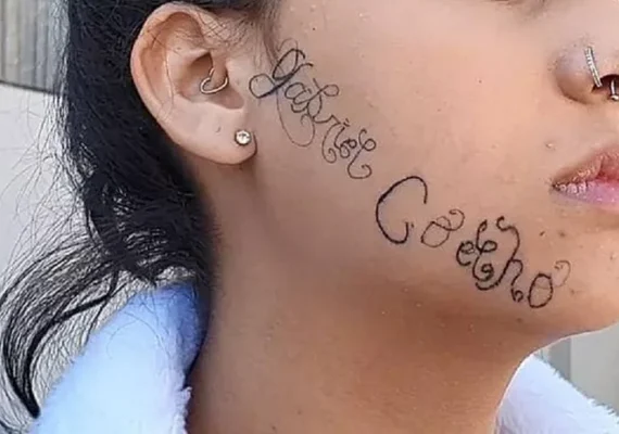 Ex-namorado tatua o próprio nome no rosto de menina à força