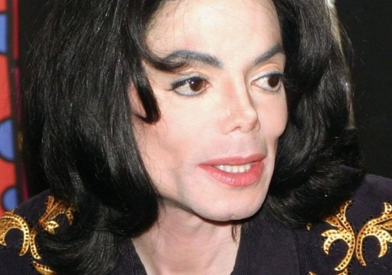 Médico diz que Michael Jackson foi castrado pelo pai