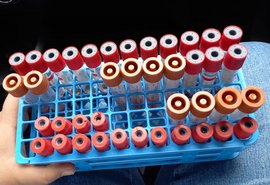 Adeal inicia coleta de amostras para identificar influenza aviária e doença de Newcastle