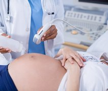Gestantes terão 50 vagas para ultrassonografia gratuita na Afya