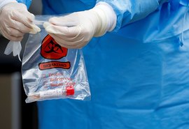 Estudo indica que maioria de infectados cria anticorpos