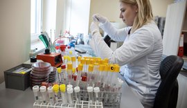 Chegam ao Brasil 500 mil testes para diagnóstico da covid-19