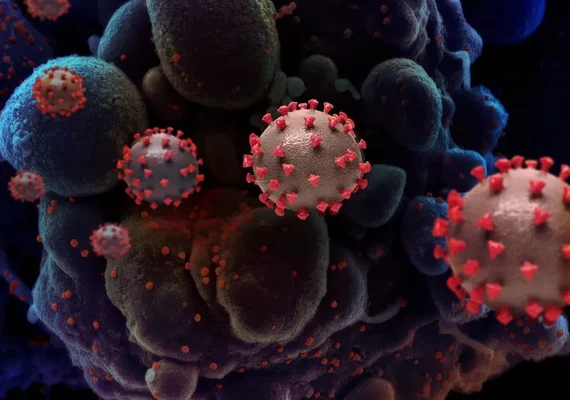 Boletim epidemiológico confirma 13 novos casos de Covid-19 no estado de Alagoas