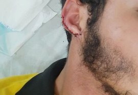 Homem que teve orelha arrancada por mordida relata que agressor circula livre pela cidade