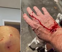 Jornalista da Globo leva 4 pontos na mão após ataque de Pitbull sem guia