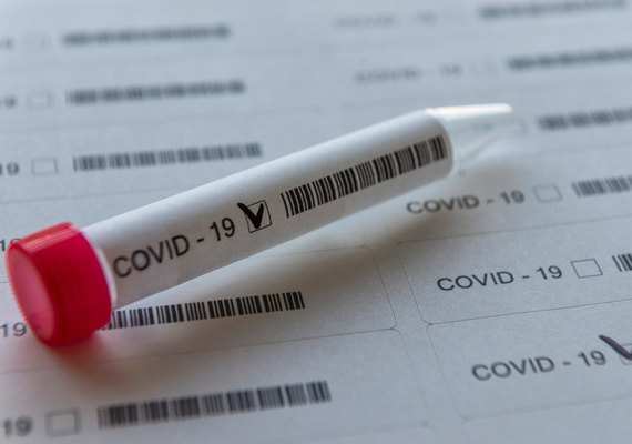 Jovem puérpera de 28 anos é uma das duas vítimas do Covid-19 nesta terça (21)