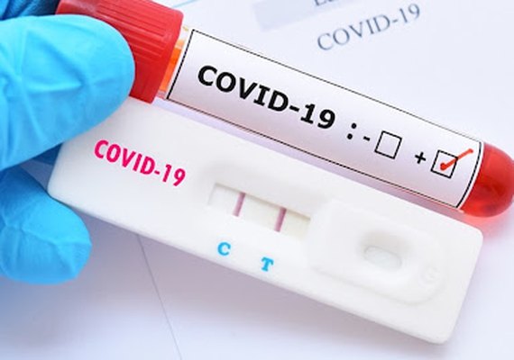 Nove municípios alagoanos registraram apenas um caso de Covid-19 nos últimos 7 dias