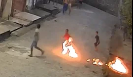 Menino de 7 anos sofre queimaduras graves nas pernas após acidente com fogos em Rio Largo