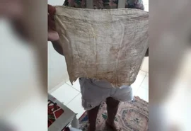 Após passar mal, mulher descobre pano dentro de si 6 meses após cesárea