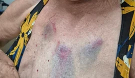 Médica é presa novamente por agredir tia idosa em Arapiraca