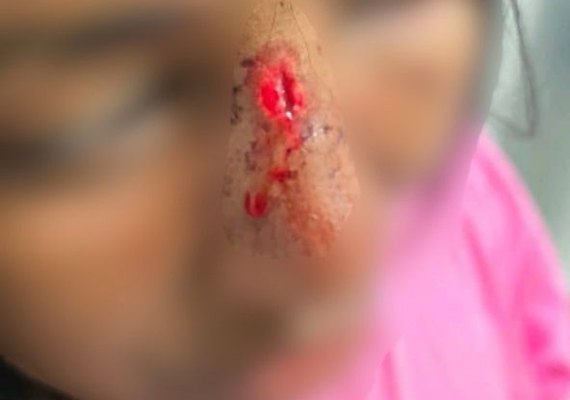 Homem é preso após espancar mulher com chutes na cabeça em Campo Alegre