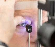 Inteligência artificial pode se tornar aliada no combate ao glaucoma