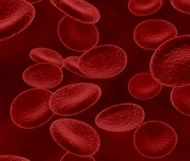 Câncer no sangue pode ser descoberto em exames de rotina