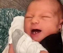 Vídeo: Recém-nascido nasce com três dentes e viraliza nas redes sociais