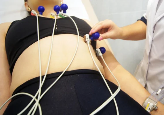 Cooperativa varejista disponibiliza exame de eletrocardiograma gratuito para a comunidade