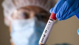 Estado registra 745 casos e 19 óbitos pela covid-19