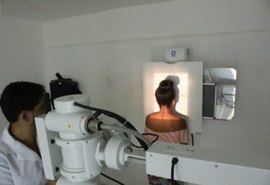 Exames por Radiodiagnóstico beneficiam população de Porto Calvo