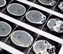 Cientistas descobrem 'interruptor do medo' no cérebro