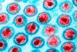 Dois novos casos de possível cura do HIV são revelados em conferência