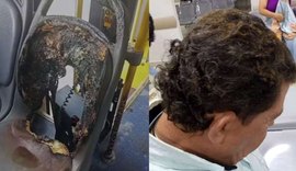 Criminosos ateiam fogo em ônibus e motorista fica ferido