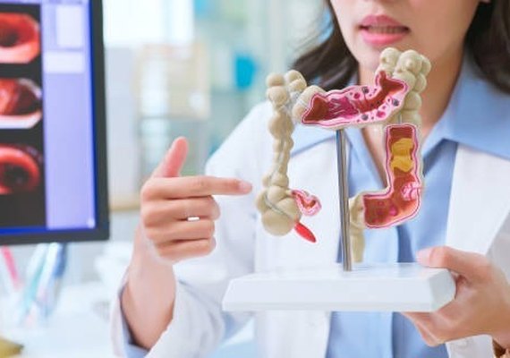 Câncer colorretal: informação e prevenção são aliados no diagnóstico precoce