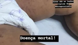 Bebê de um ano morre por meningite em Maceió
