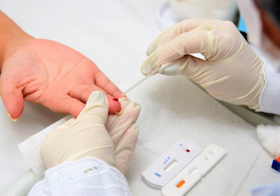 Brasileiro vive sem sinais do HIV após tratamento inovador: 'Achava impossível'