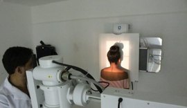 Exames por Radiodiagnóstico beneficiam população de Porto Calvo