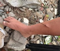 Criança tem perna perfurada por vergalhão em terreno baldio de Arapiraca