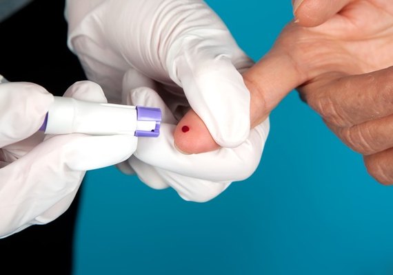 Pesquisadores desenvolvem testes rápidos para detectar coronavírus