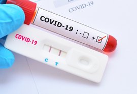 Planos de saúde serão obrigados a cobrir testes para Covid-19