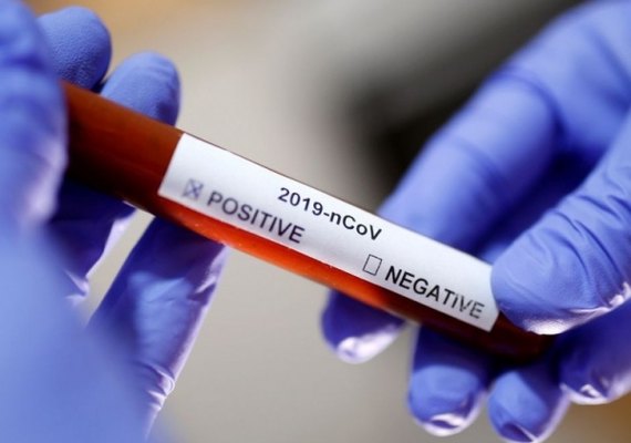 Sesau confirma resultado positivo para caso de coronavírus em AL