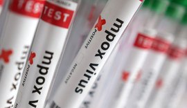 Casos confirmados de Mpox chegam a 140 no Brasil em 2026