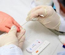 Sesau orienta sobre as medidas para evitar as hepatites virais