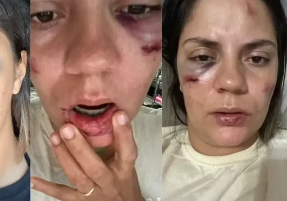 Mulher é arremessada de montanha-russa em parque aquático recém-inaugurado: ‘Desesperador’