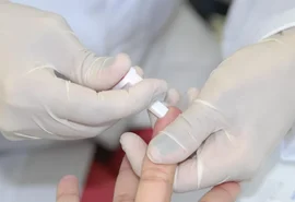 Sesau orienta como prevenir, diagnosticar e tratar as hepatites virais