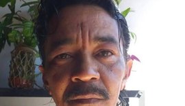 Morre sobrevivente do acidente com césio-137 em Goiás após décadas