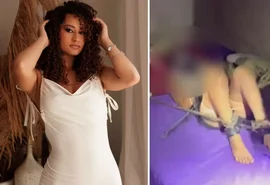 Mulher resgatada de cativeiro relata abusos e queimaduras com ácido na boca