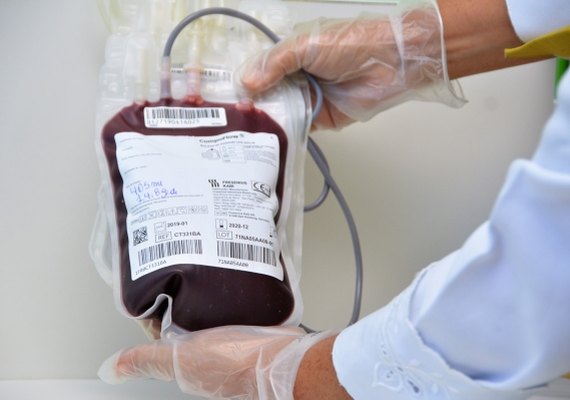 Unidades Trapiche e Farol do Hemoal não funcionarão nesta  terça-feira