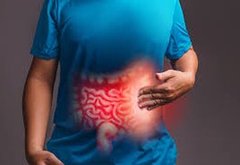 Os cuidados necessários para evitar doenças inflamatórias intestinais