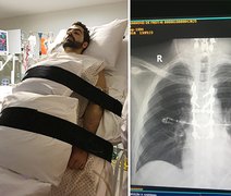 Cientista da UFRJ cria proteína que pode recuperar movimentos após lesão na medula