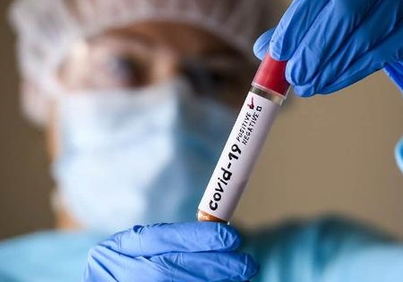 Estado registra 745 casos e 19 óbitos pela covid-19