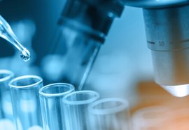 Vital Brazil e UFRJ testam soro para tratar covid-19