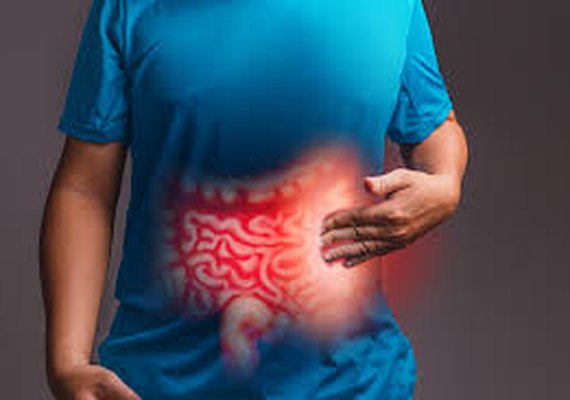 Os cuidados necessários para evitar doenças inflamatórias intestinais