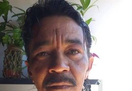 Morre sobrevivente do acidente com césio-137 em Goiás após décadas