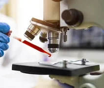 Proteínas encontradas no sangue podem indicar câncer com 7 anos de antecedência