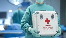 Pandemia prejudica transplante de órgãos no Brasil